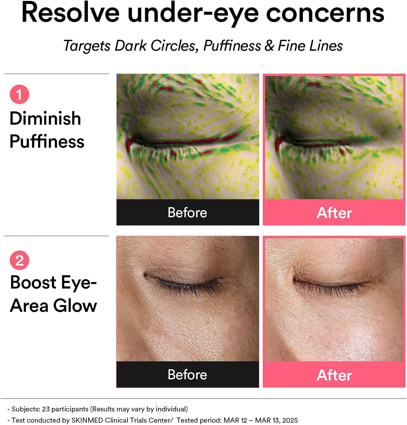 Abib PDRN Retinal Eye Patch, máscaras de hidrogel para olheiras, inchaço, linhas finas, 60 adesivos, 84 g, com niacinamida, K-Beauty Skincare